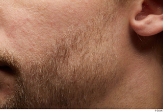HD Face Skin Erling bearded cheek ear face facial hair…